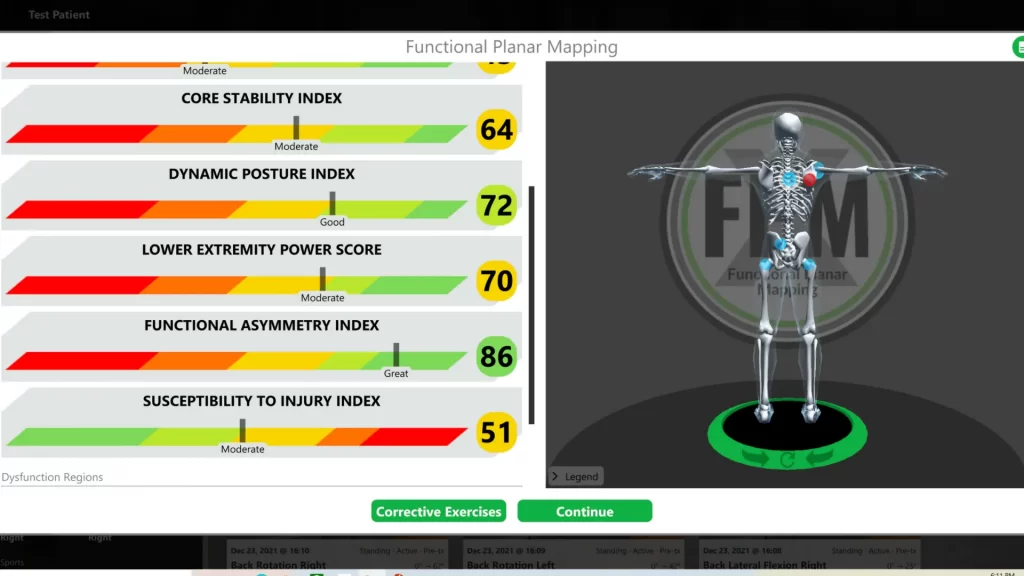 KAMS functional planar mapping