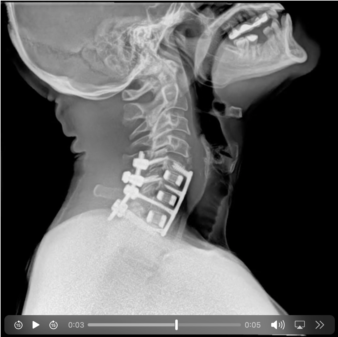 in-the-future-we-will-evaluate-you-with-dynamic-digital-x-ray-neck