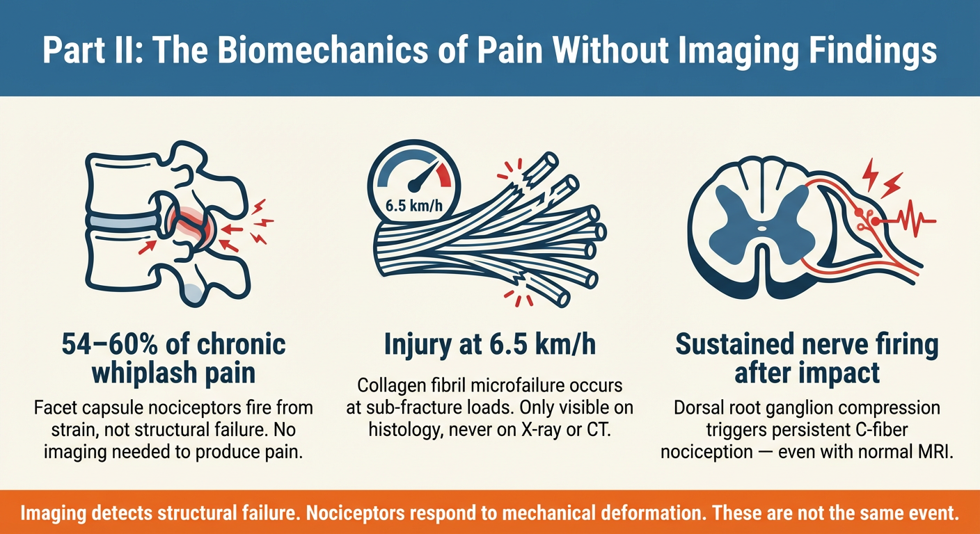 Beyond the X-Ray: Why Absence of Evidence Is Not Evidence of Absence in Whiplash and Low-Velocity Collision Injuries 5 Infographic — The Biomechanics of Pain Without Imaging Findings